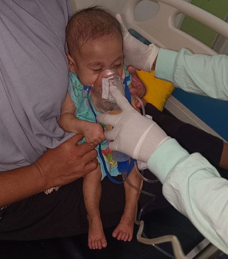 Adik Siti Maryam tengah mendapat bantuan oxigen karena alami gangguan pernafasan.(Foto/Net)